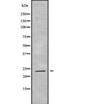 RAB19 Antibody in Western Blot (WB)