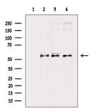 Phospho-AKT1/AKT2/AKT3 (Ser473) Antibody in Western Blot (WB)