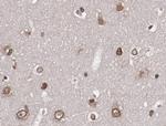 Phospho-AKT1/AKT2/AKT3 (Ser473) Antibody in Immunohistochemistry (Paraffin) (IHC (P))