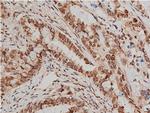 Phospho-AKT1/AKT2/AKT3 (Ser473) Antibody in Immunohistochemistry (Paraffin) (IHC (P))