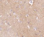 Factor VIII Antibody in Immunohistochemistry (Paraffin) (IHC (P))