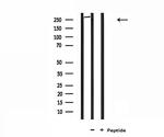 Factor VIII Antibody in Western Blot (WB)