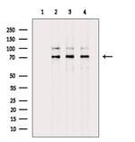 Involucrin Antibody in Western Blot (WB)