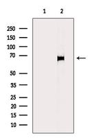 Involucrin Antibody in Western Blot (WB)