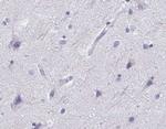 Involucrin Antibody in Immunohistochemistry (IHC)