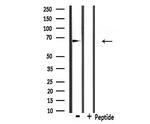 Involucrin Antibody in Western Blot (WB)