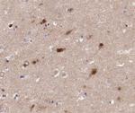 JM4 Antibody in Immunohistochemistry (Paraffin) (IHC (P))