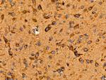 JM4 Antibody in Immunohistochemistry (Paraffin) (IHC (P))