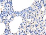 Mammaglobin A Antibody in Immunohistochemistry (Paraffin) (IHC (P))