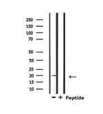 Mammaglobin A Antibody in Western Blot (WB)