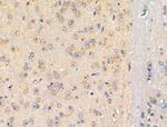 MMP14 Antibody in Immunohistochemistry (Paraffin) (IHC (P))