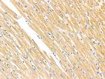 MMP14 Antibody in Immunohistochemistry (Paraffin) (IHC (P))