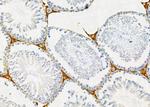 OCT2 Antibody in Immunohistochemistry (Paraffin) (IHC (P))