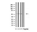 OCT2 Antibody in Western Blot (WB)