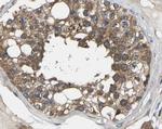 Pan Ras Antibody in Immunohistochemistry (Paraffin) (IHC (P))