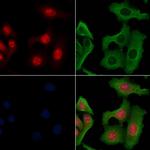 PIAS3 Antibody in Immunocytochemistry (ICC/IF)