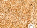 PIAS3 Antibody in Immunohistochemistry (Paraffin) (IHC (P))