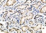 UBA2 Antibody in Immunohistochemistry (Paraffin) (IHC (P))