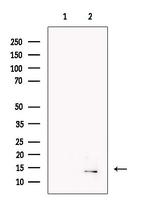 Urocortin Antibody in Western Blot (WB)