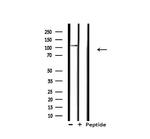 XPF Antibody in Western Blot (WB)