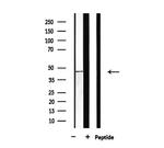 BCKDK Antibody in Western Blot (WB)