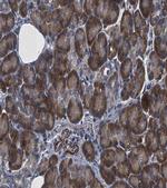 HGS Antibody in Immunohistochemistry (Paraffin) (IHC (P))