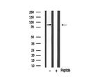 HGS Antibody in Western Blot (WB)