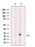 KIP2 Antibody in Western Blot (WB)