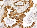 TRIM16 Antibody in Immunohistochemistry (Paraffin) (IHC (P))