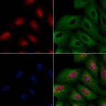 ATRX Antibody in Immunocytochemistry (ICC/IF)