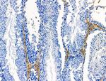 DUS2L Antibody in Immunohistochemistry (Paraffin) (IHC (P))