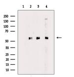 DUS2L Antibody in Western Blot (WB)