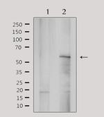 YTHDF1 Antibody in Western Blot (WB)