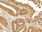 MUC13 Antibody in Immunohistochemistry (Paraffin) (IHC (P))