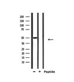 MUC13 Antibody in Western Blot (WB)