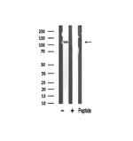 ZMYND8 Antibody in Western Blot (WB)