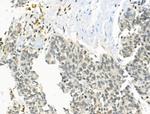 ZMYND8 Antibody in Immunohistochemistry (Paraffin) (IHC (P))