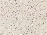 ZMYND8 Antibody in Immunohistochemistry (Paraffin) (IHC (P))