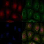 MAGE1 Antibody in Immunocytochemistry (ICC/IF)