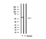 SMAD1/SMAD5/SMAD9 Antibody in Western Blot (WB)