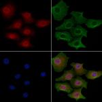 CKS2 Antibody in Immunocytochemistry (ICC/IF)