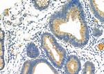 DAK Antibody in Immunohistochemistry (Paraffin) (IHC (P))