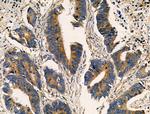 ALPK2 Antibody in Immunohistochemistry (Paraffin) (IHC (P))