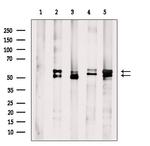 AKT Pan Antibody in Western Blot (WB)