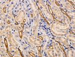 AKT Pan Antibody in Immunohistochemistry (Paraffin) (IHC (P))