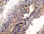 AKT Pan Antibody in Immunohistochemistry (Paraffin) (IHC (P))