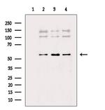 AKT Pan Antibody in Western Blot (WB)