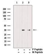 Phospho-Cyclin D1 (Thr286) Antibody in Western Blot (WB)