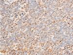 Phospho-JAK1 (Tyr1034) Antibody in Immunohistochemistry (Paraffin) (IHC (P))