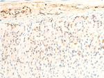 Phospho-JAK1 (Tyr1034) Antibody in Immunohistochemistry (Paraffin) (IHC (P))